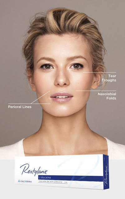 Models features highlighted to improve with Restylane Lidocaine lip filler